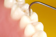dental exam