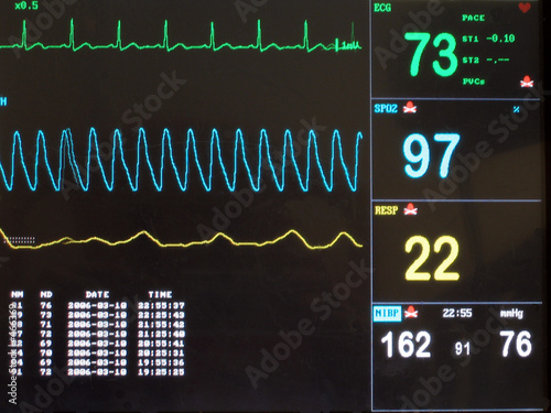 ecg screen ecg screen