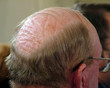 head and time