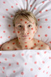 woman with red spots on face and body
