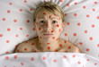 woman with red spots on face and body
