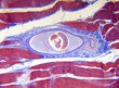 microscope-trichinella spiralis