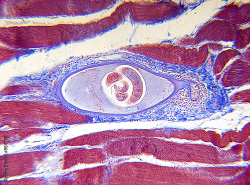 Photo: microscope-trichinella spiralis microscope-trichinella spiralis
