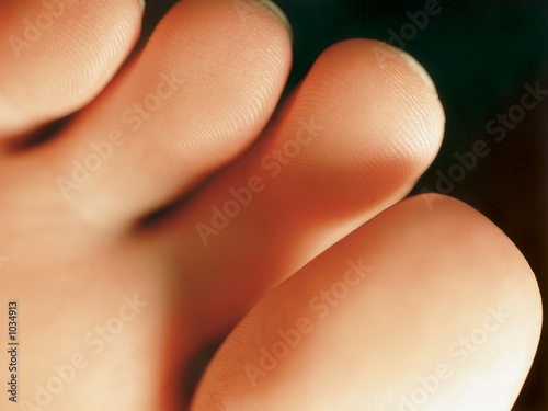 Photo: underside of the toes underside of the toes