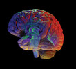 brain on black
