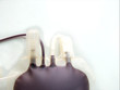 human blood detail