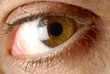 brown eye 2