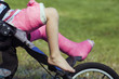 broken leg
