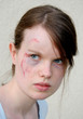 Photo: injured woman 2 injured woman 2