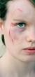 injured cheek