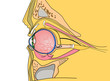 Foto: medical illustration of the human eye medical illustration of the human eye