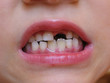 gap toothed grimace