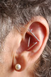 acupuncture needles in ear