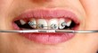 orthodontie