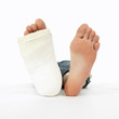 girl with a broken leg
