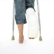 girl with a broken leg