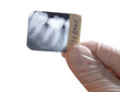 x-ray teeth diagnostics