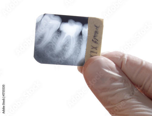x-ray teeth diagnostics