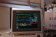 vital signs monitor vital signs monitor