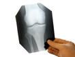 x-ray knee diagnostics