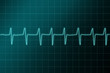 cardiogram ritm cardiogram ritm