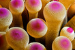 caribbean anemone