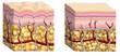cellulite cross section cellulite cross section