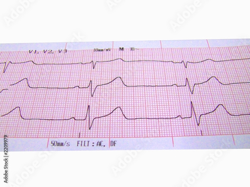 heart rate ecg