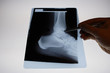 Foto: img_2823radiographie img_2823radiographie