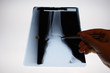img_2827radiographie