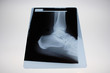 img_2821radiographie
