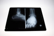 img_2810radiographie