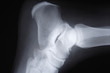 Foto: img_2813radiographie img_2813radiographie