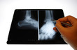 Foto: img_2815radiographie img_2815radiographie