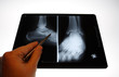 img_2817radiographie