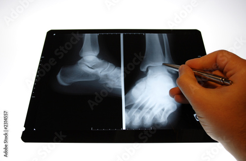 img_2815radiographie img_2815radiographie