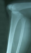   	knee x-ray