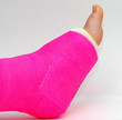 pink cast