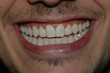 sourire 3