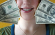 expensive braces