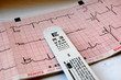 ecg view