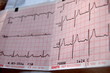 heart rate