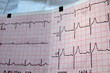 ecg view