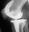 knee xray