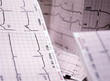 ecg