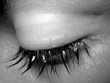 lashes
