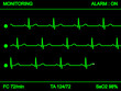 monitoring