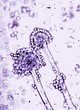 Photo: microscopic life microscopic life