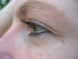 auge