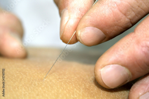 chinese medicine treatment